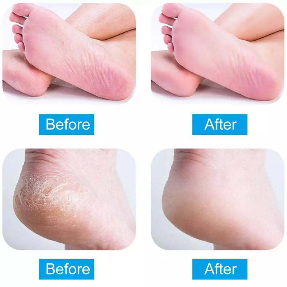 Foot File Hard Skin Callus Remover